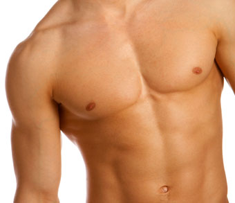 Gynecomastia