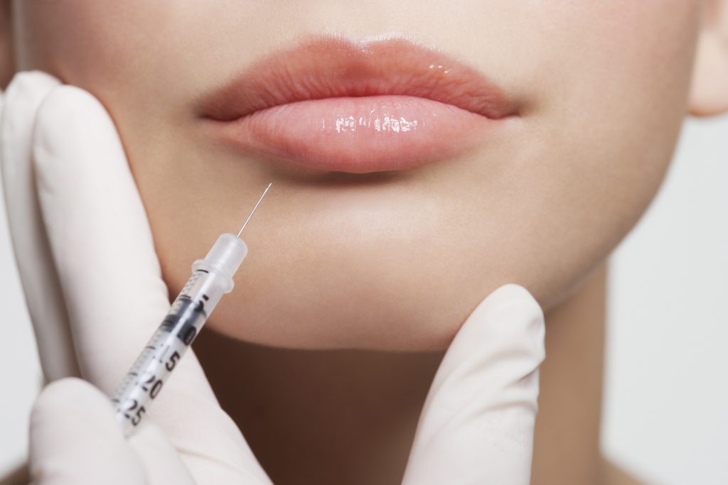 lip fillers San Antonio